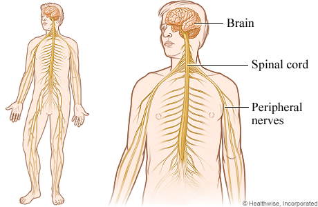 What is a ‘trapped nerve’?