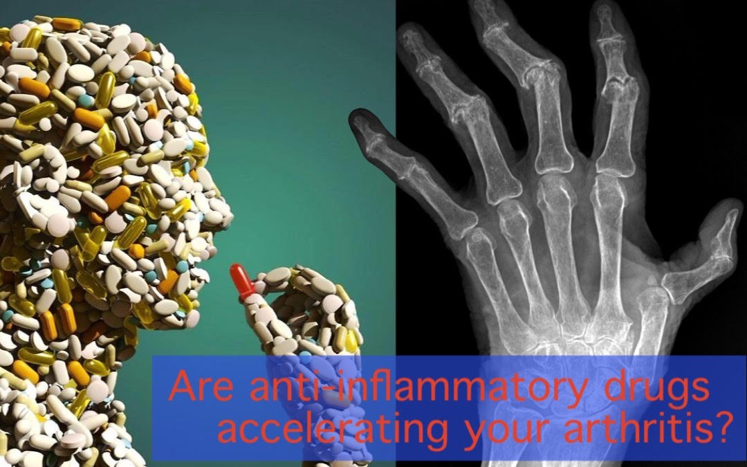 Can the anti-inflammatory drugs you’re taking actually accelerate your arthritis?