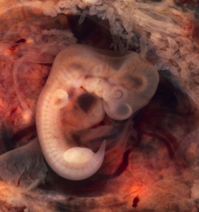 Human embryo with head and tail